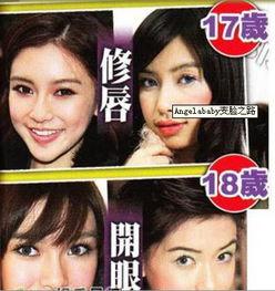 福州整形爆料事件视频最新,揭露行业黑幕,真相令人震惊 第1张 福州整形爆料事件视频最新,揭露行业黑幕,真相令人震惊 第1张